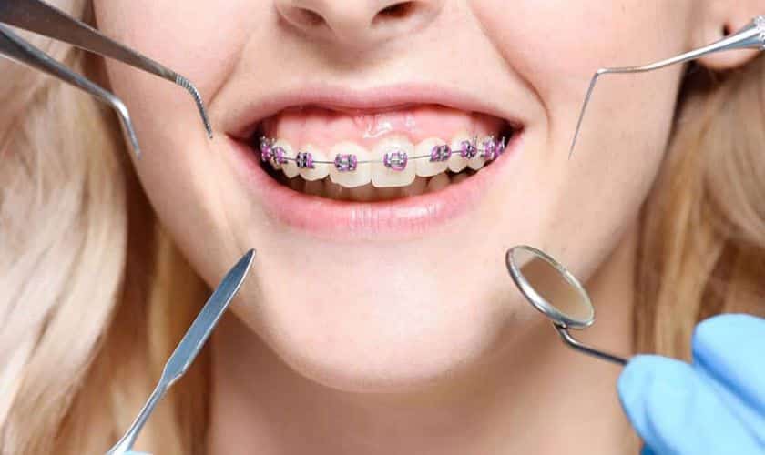 Orthodontic